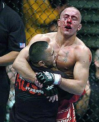 Жорж Сен-Пьер после боя с БиДжей Пенном на UFC 58